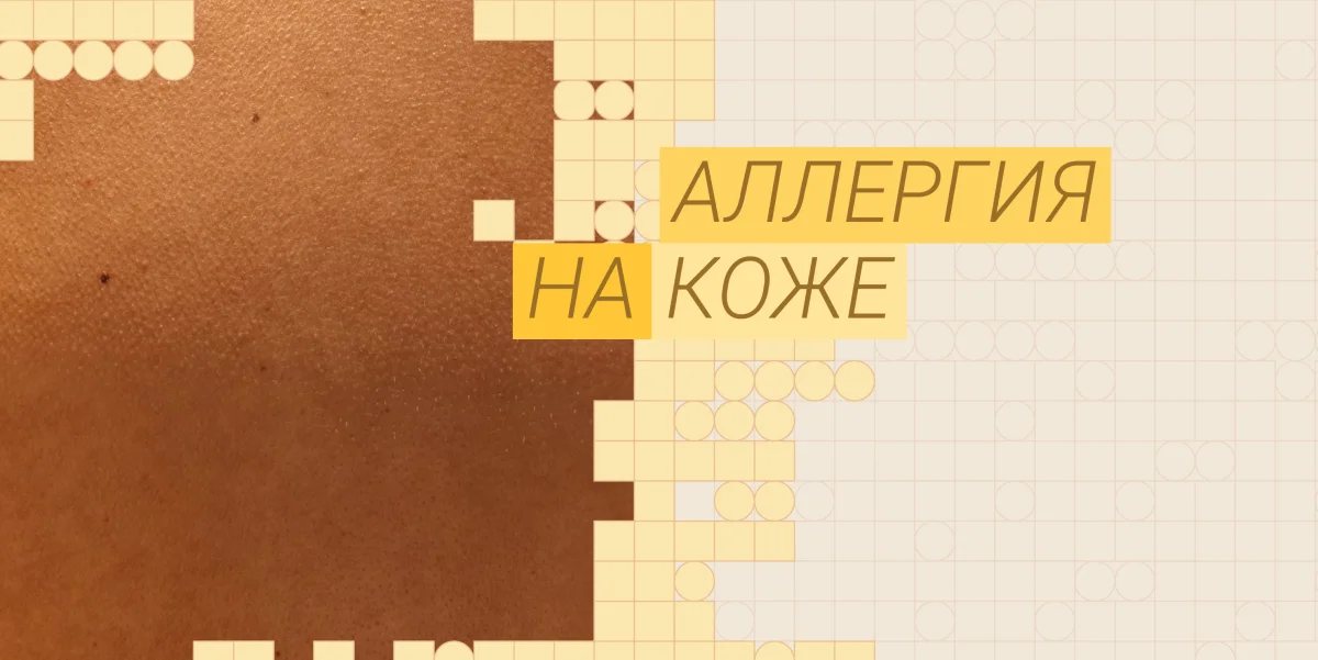 Аллергия на коже: виды, как выглядит и чем лечить в 2026 году